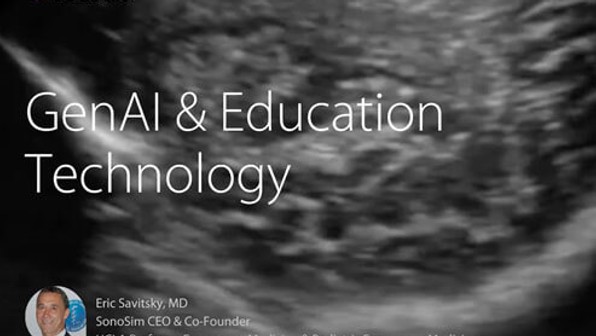 SonoSim + Vectara Success Story